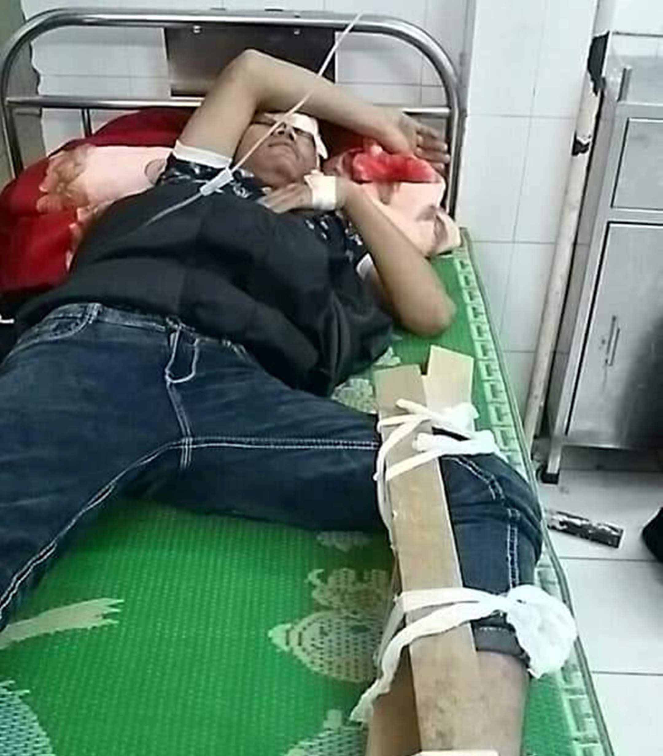 Anh Nay Dương đã bị gãy chân sau vụ tai nạn. Ảnh: Văn Ngọc