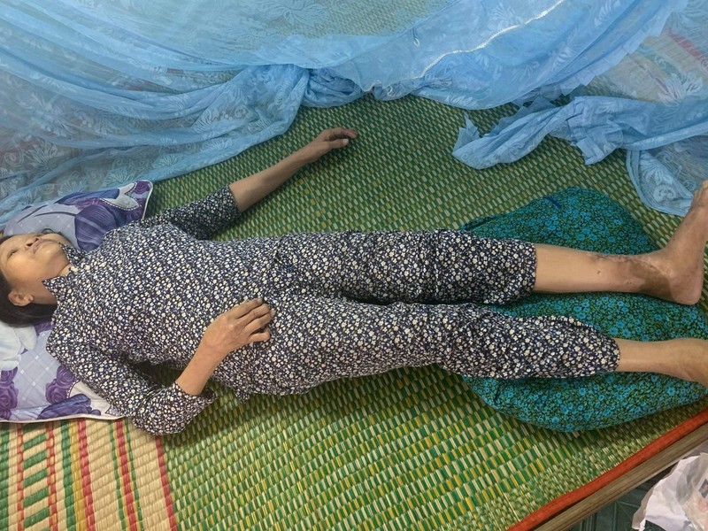 Bà Phạm Thị Ngọc Liễu (mẹ của chị Mai) bị gãy chân không có khả năng lao động. Vbtt 01