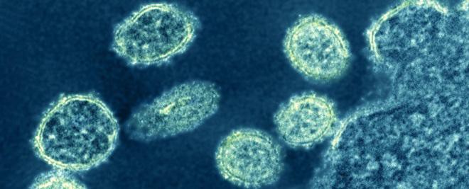Những sự thật đáng sợ về dịch cúm lợn chủng mới tại Trung Quốc: Virus mang sự kết hợp hủy diệt, chưa có bất kỳ miễn dịch nào tồn tại Ảnh 3
