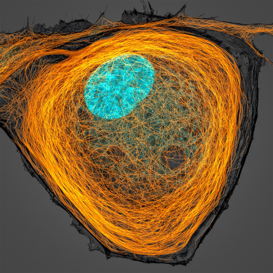 Các vi ống (màu cam) bên trong tế bào. Phần màu lục lam chính là các hạt nhân. Ảnh của chuyên gia Jason Kirk tại Đại học Y khoa Baylor (Mỹ).