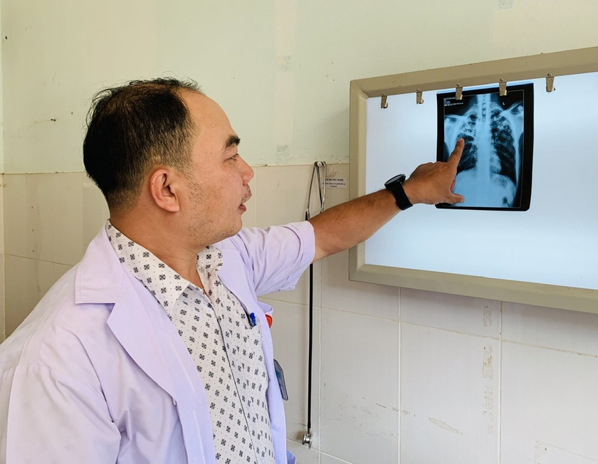 Bác sĩ CKI Lương Quang Vinh cho biết đa số bệnh nhân đến Bệnh viện Lao và bệnh phổi tỉnh đều là bệnh nhân nặng, đã có tổn thương lớn ở phổi, kèm theo nhiều bệnh lý khác. Ảnh: Như Nguyện
